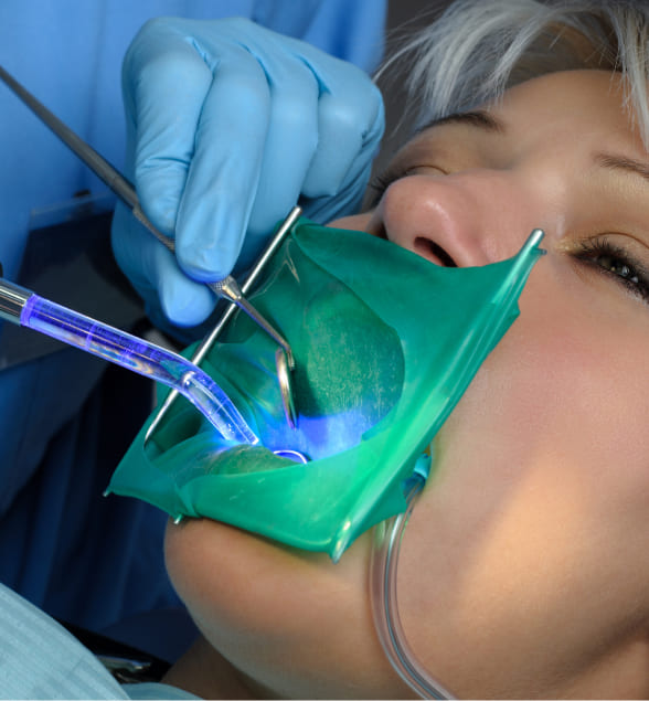 tratamiento de conductos realizado por endodoncista