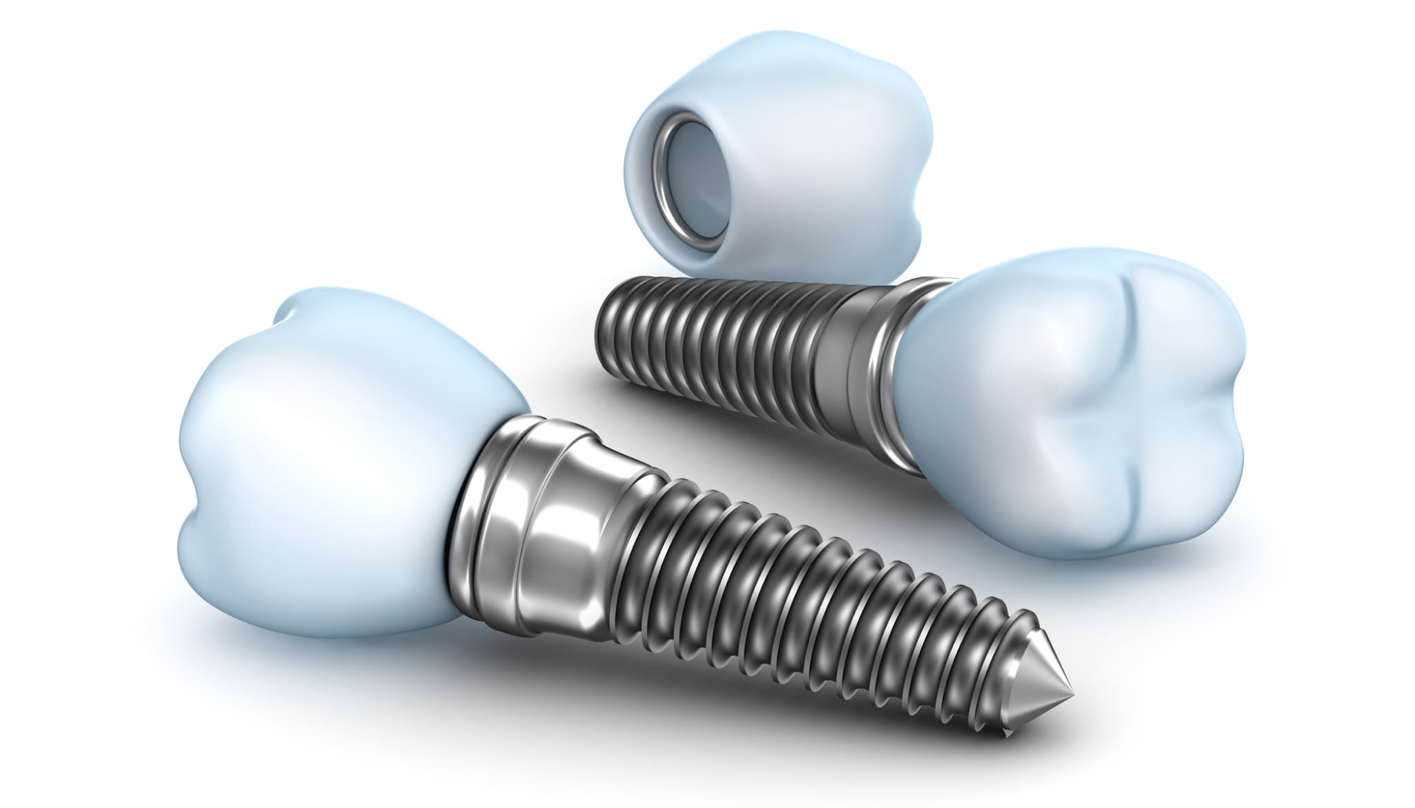 implantes dentales en Medellín