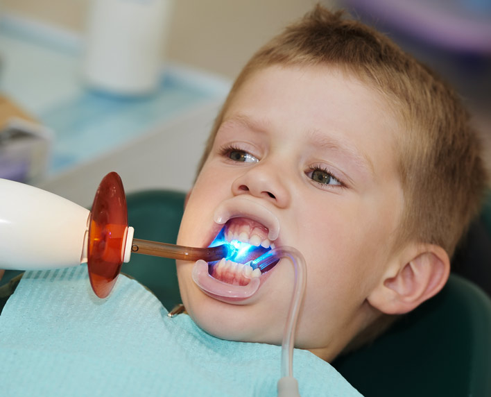 caries en niños