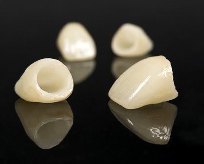 corona dental