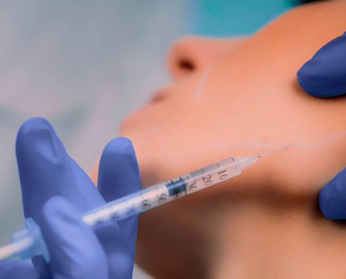 infiltraciones de botox para bruxismo