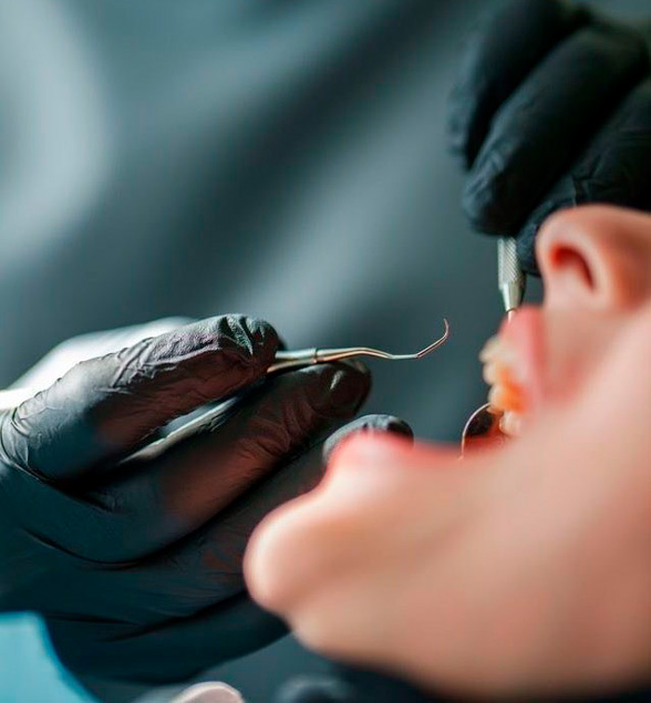 periodoncia en medellin