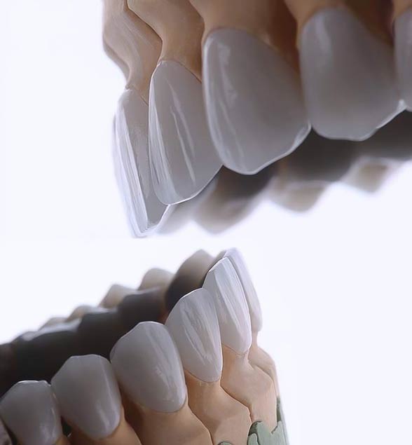 protesis y coronas dentales en medellin