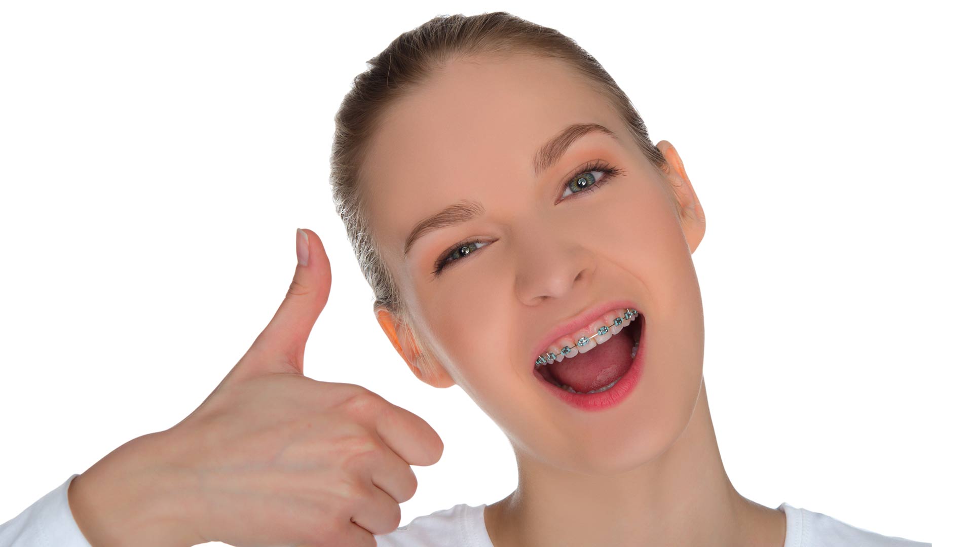 persona sonriendo con brackets metálicos