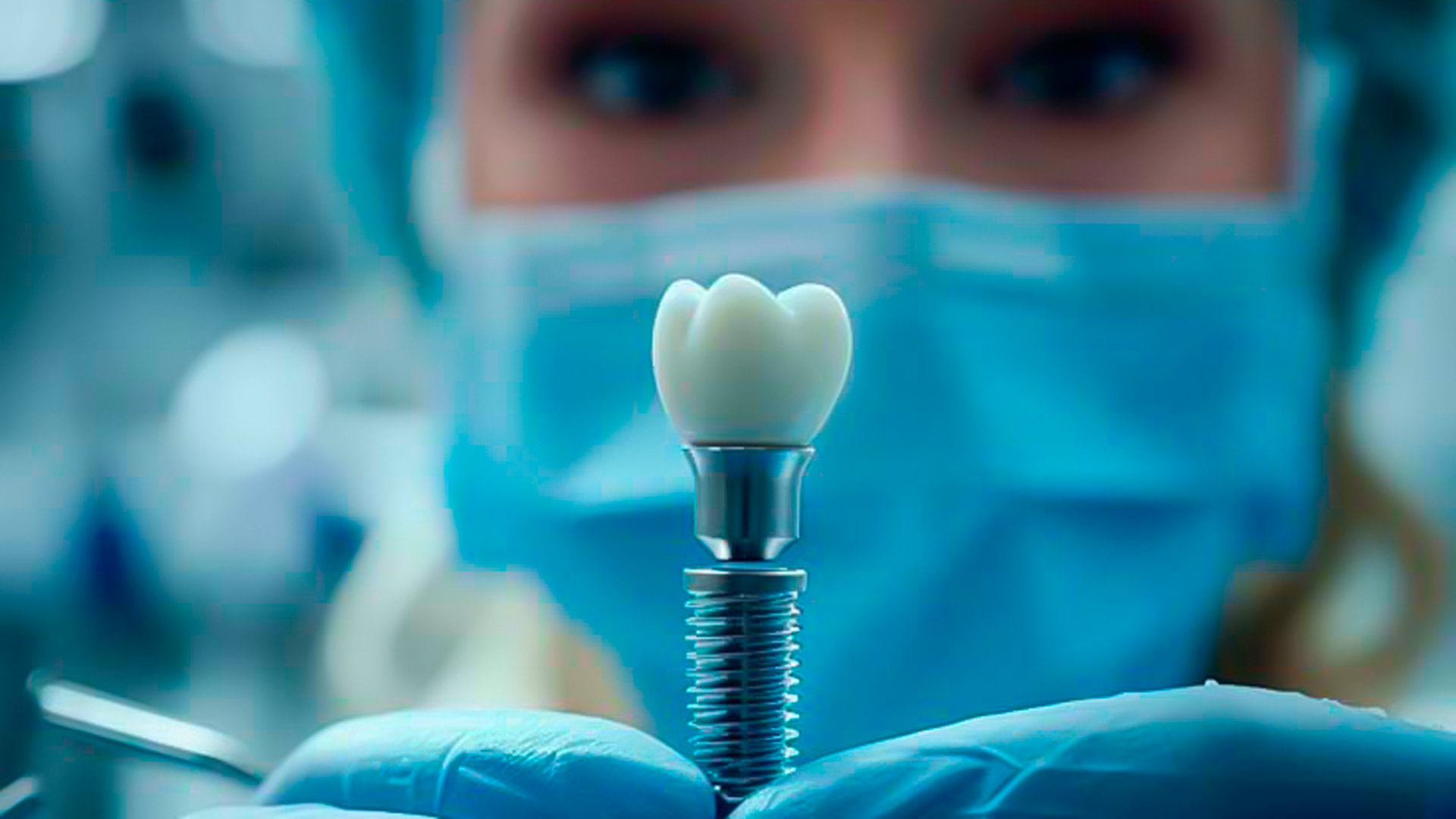 colocacion de un implante dental