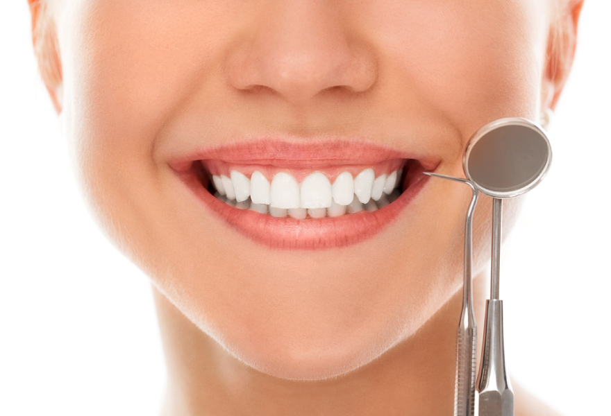 Indicaciones de cuidado durante el blanqueamiento dental