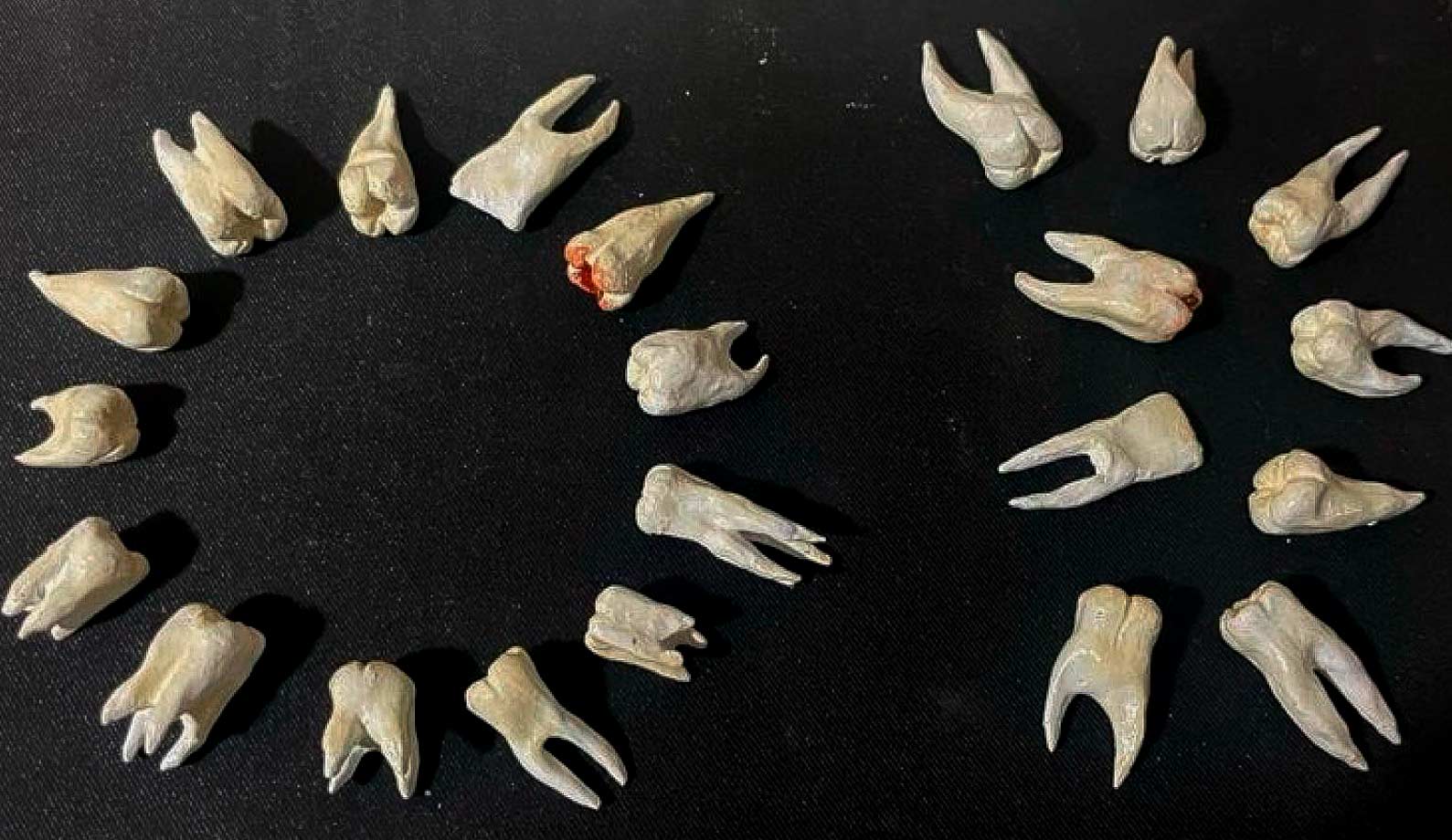 las cordales tuercen los dientes