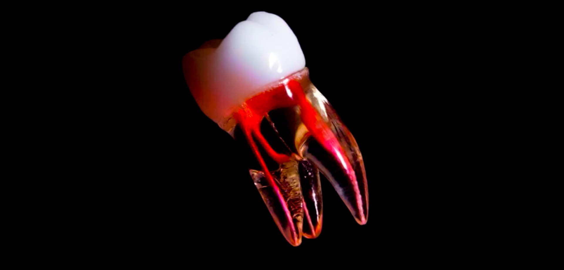 que es la pulpa dental