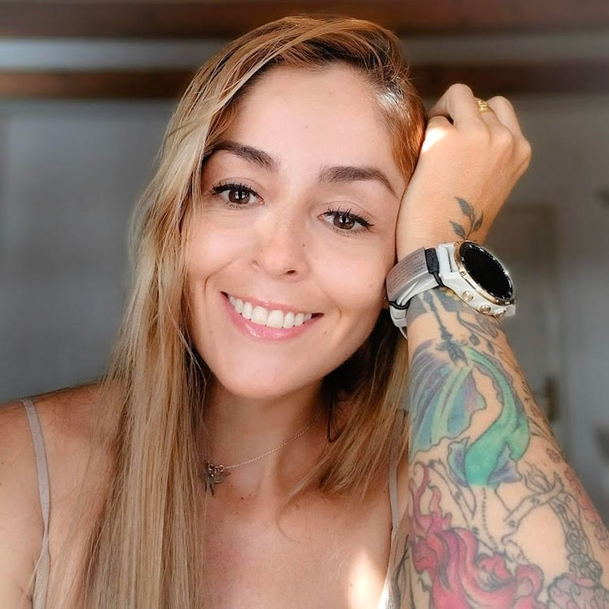 lorena hoyos microdiseño de sonrisa