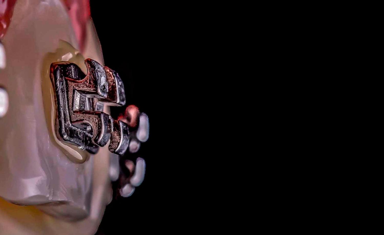 brackets metalicos medellin