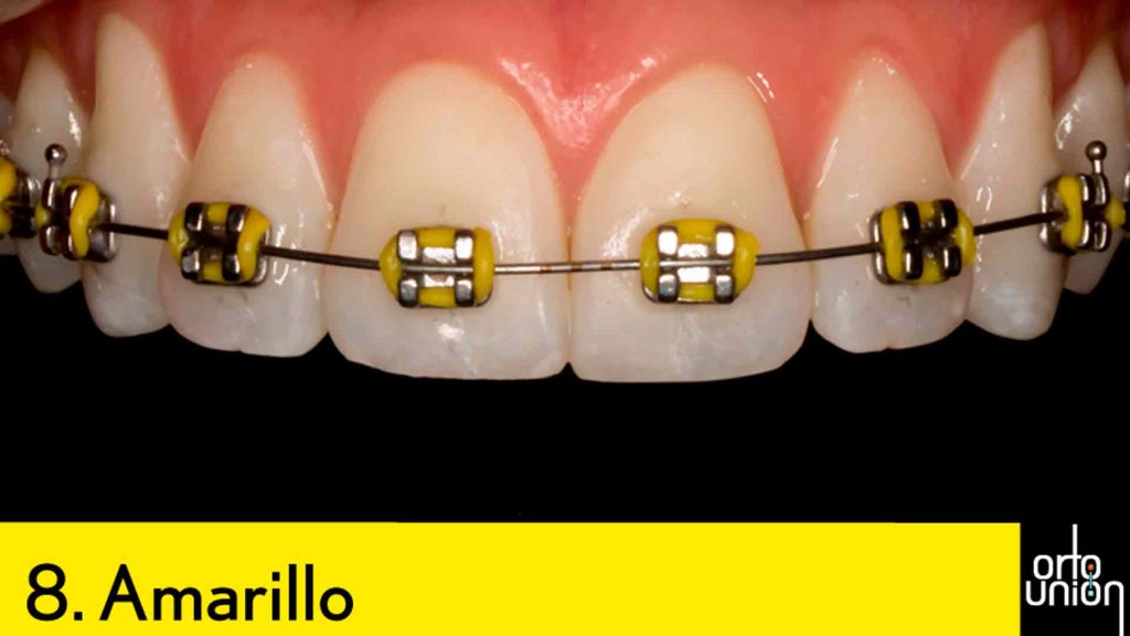 cauchos color amarillo para brackets