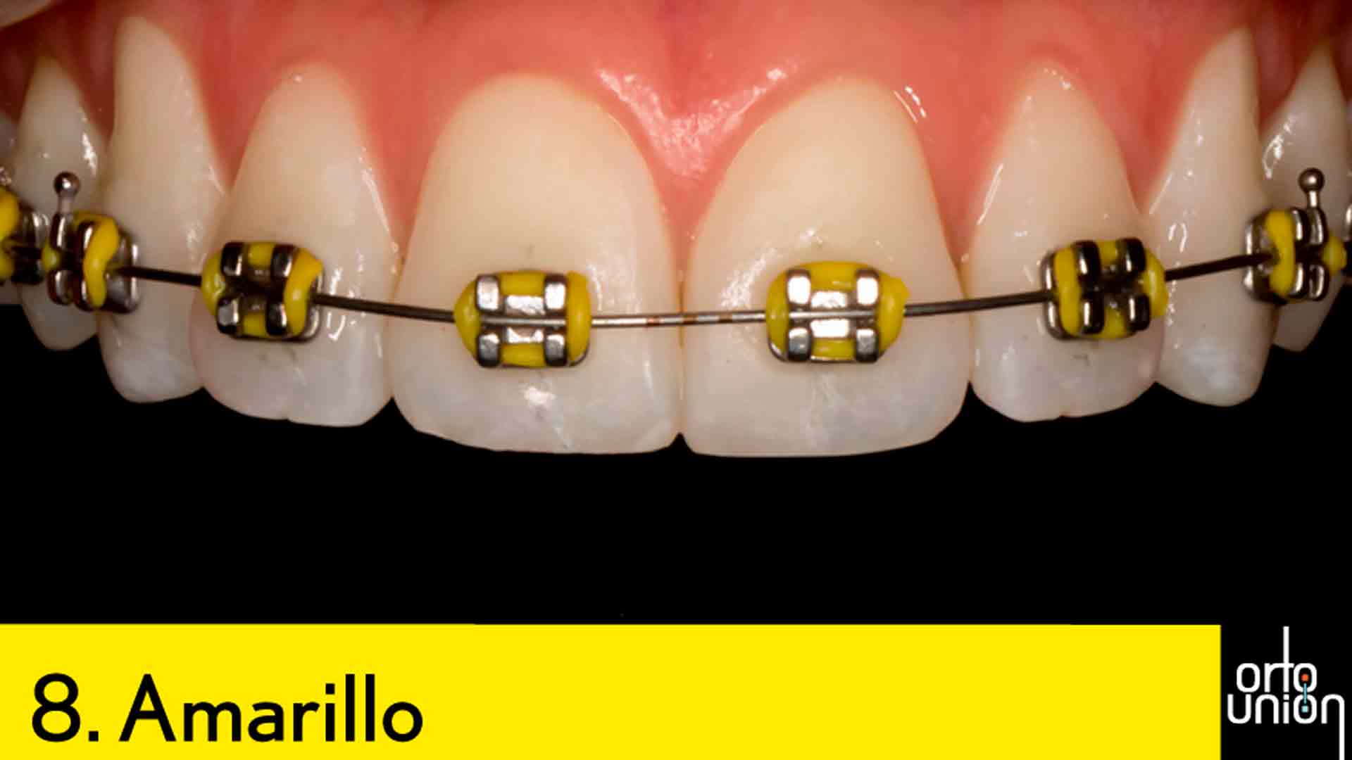 cauchos color amarillo para brackets