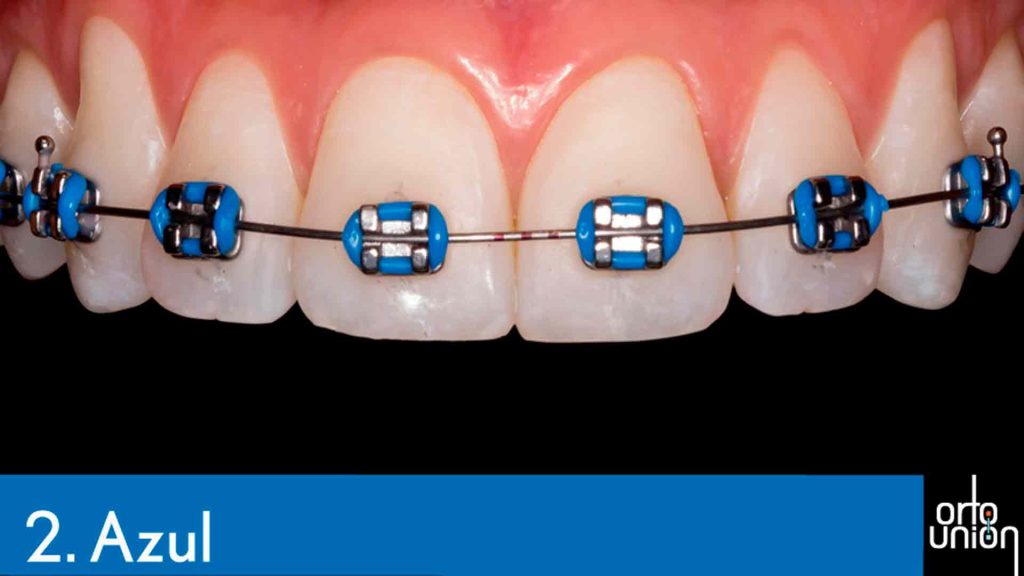 cauchos color azul para brackets