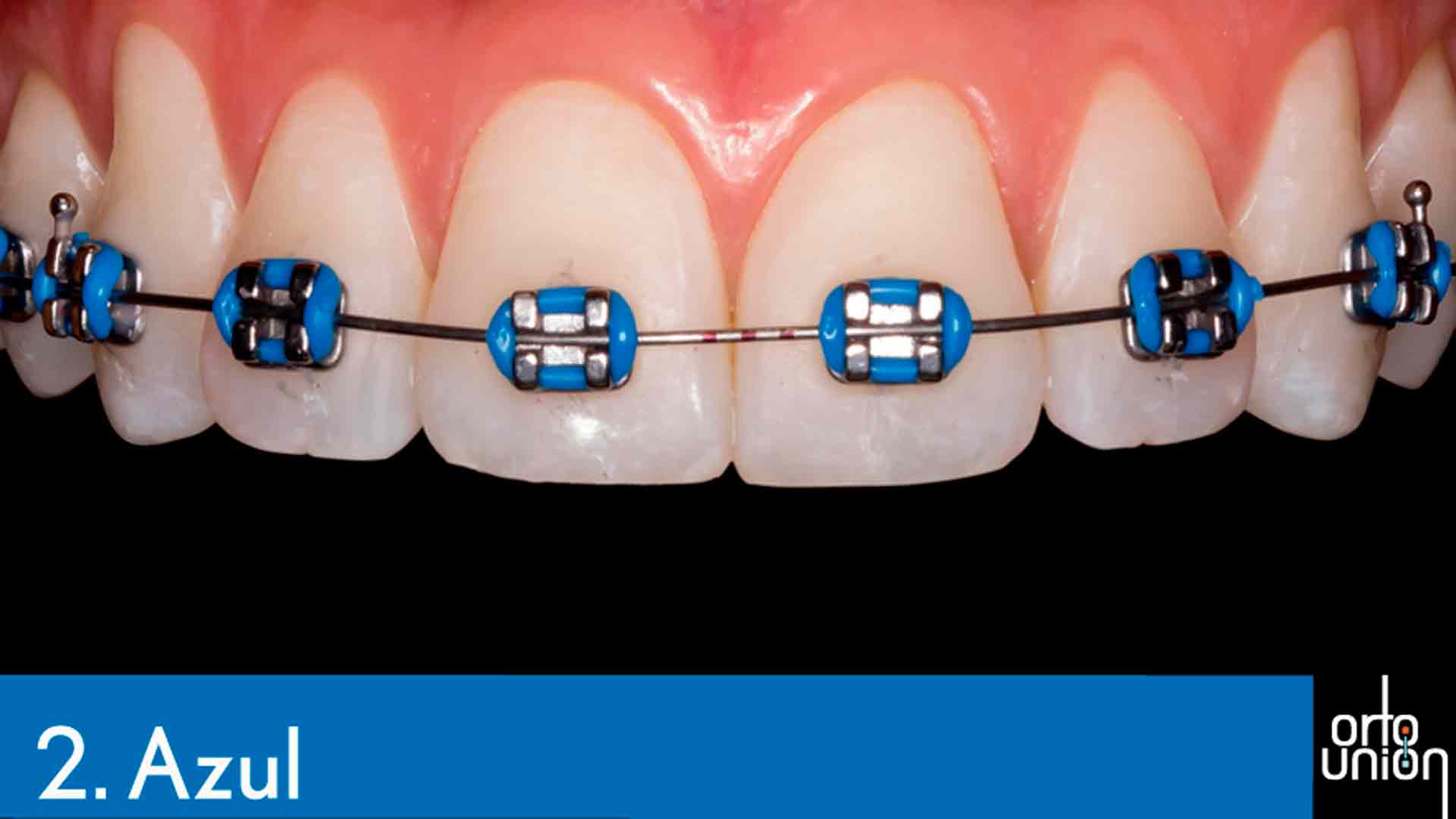 cauchos color azul para brackets