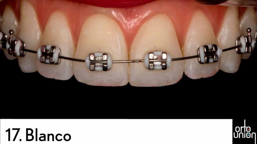 cauchos color blanco para brackets