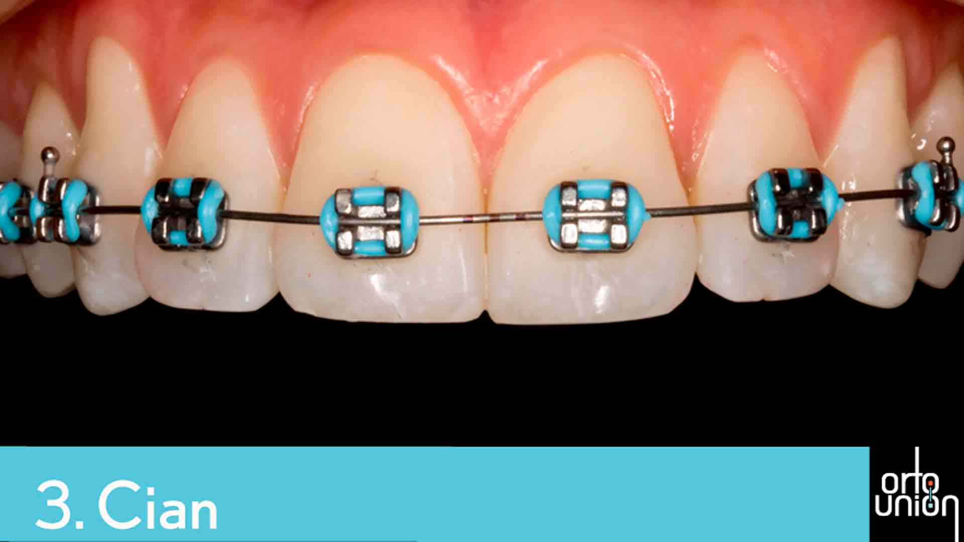 cauchos color cian para brackets