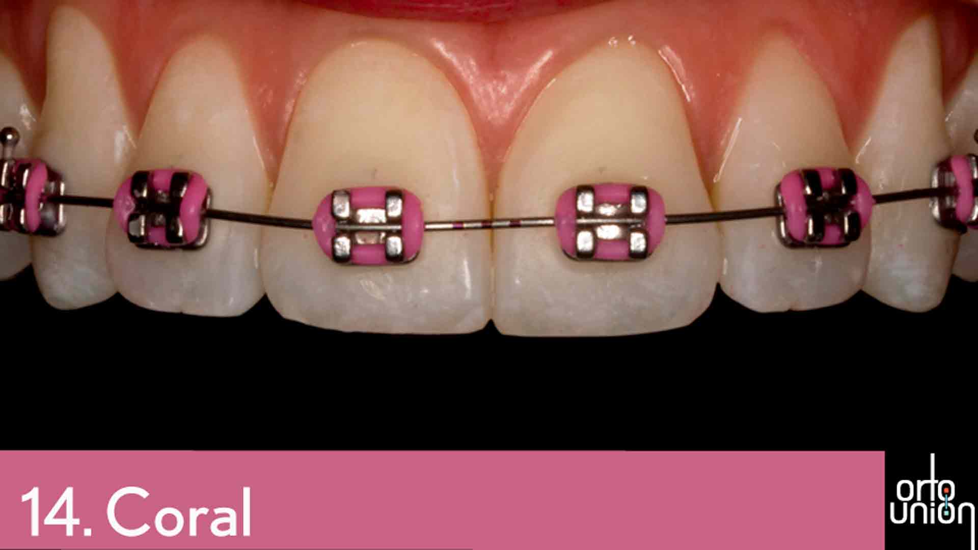 cauchos color coral para brackets