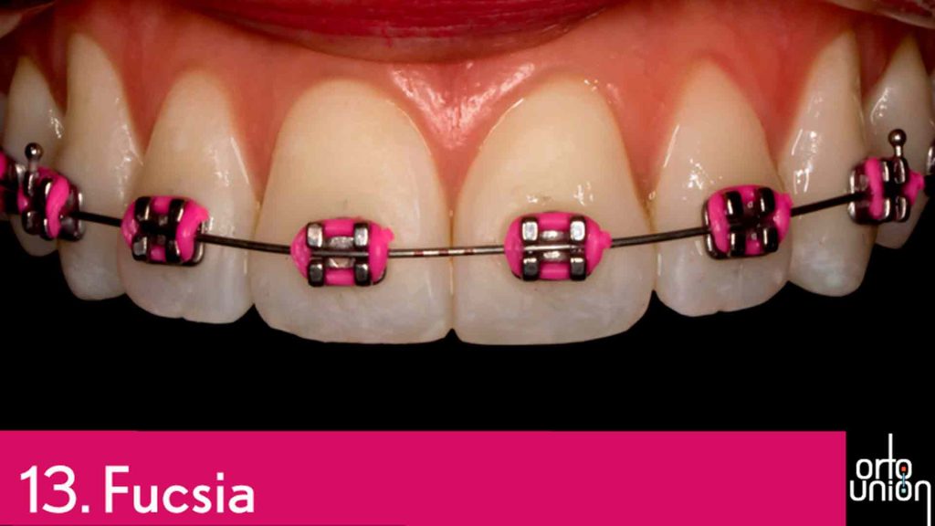 cauchos color fucsia para brackets