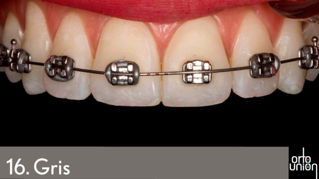 cauchos color gris para brackets