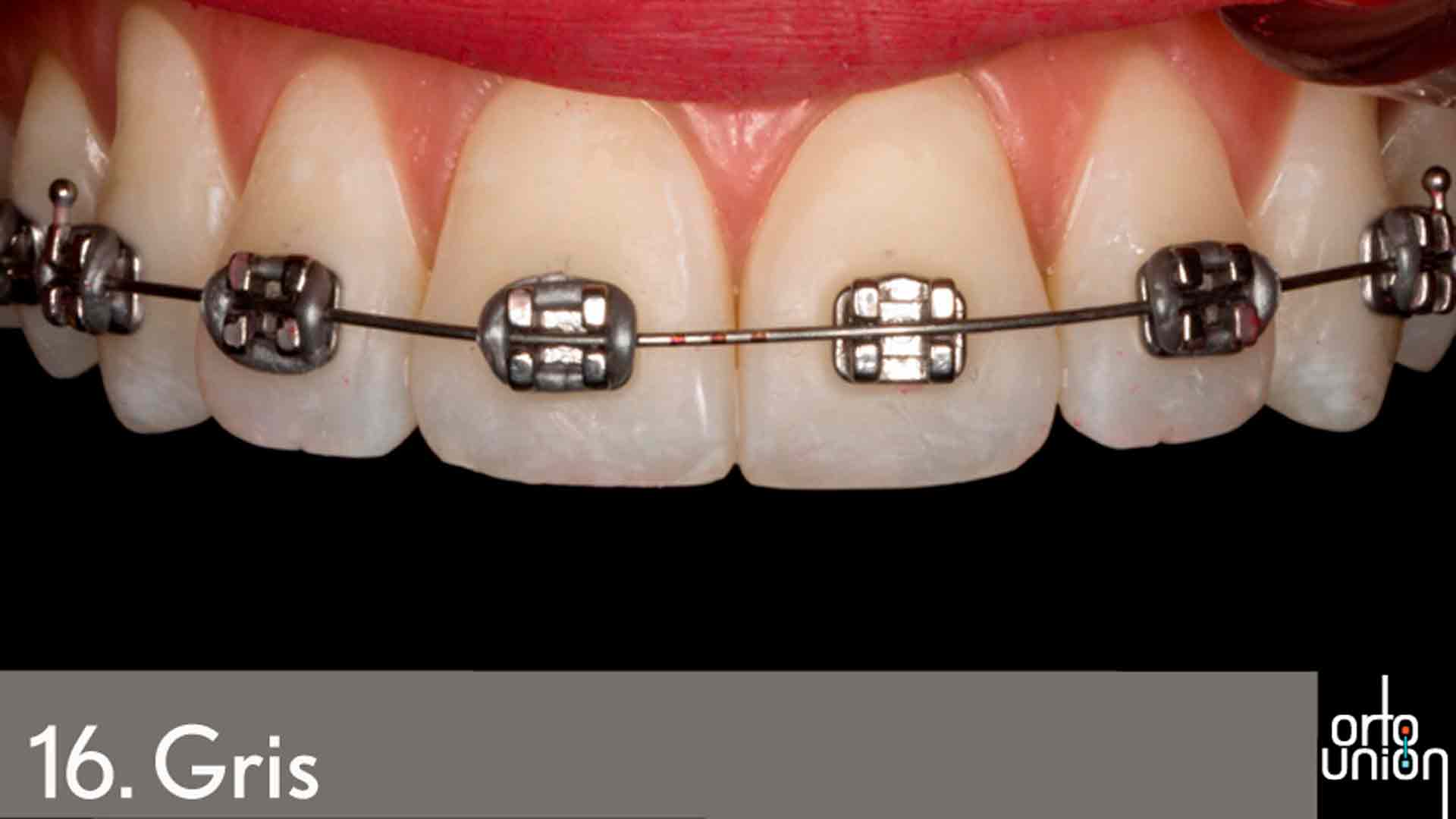 cauchos color gris para brackets