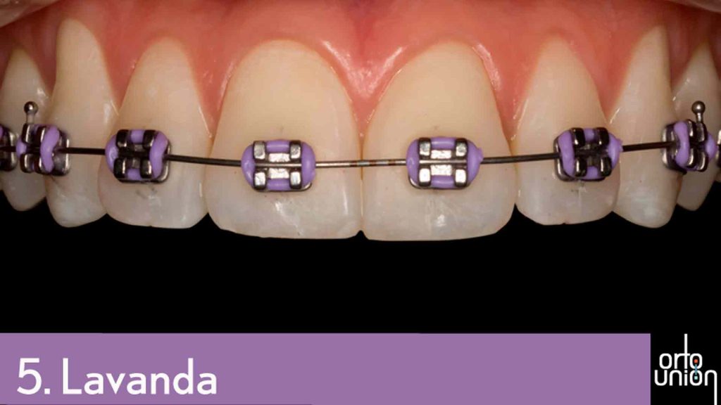cauchos color lavanda para brackets