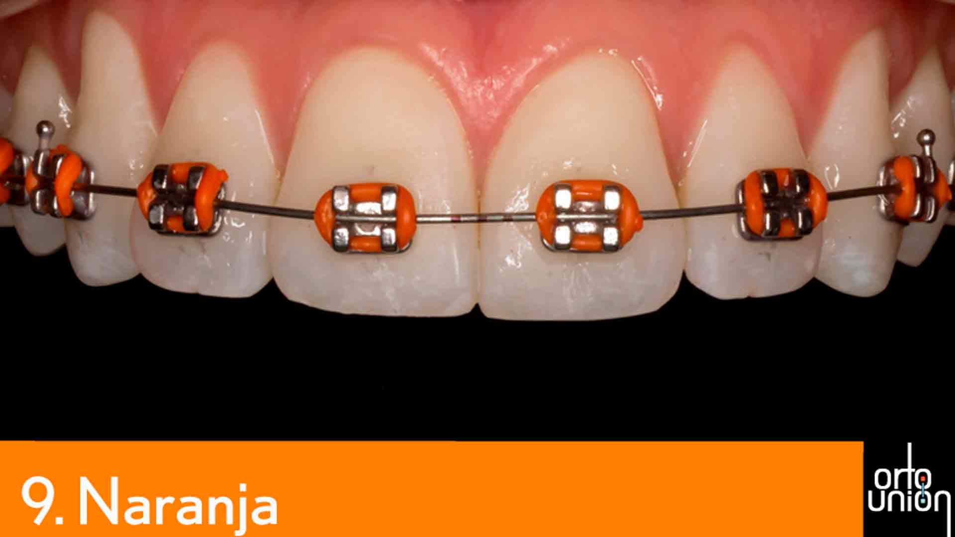 cauchos color naranja para brackets