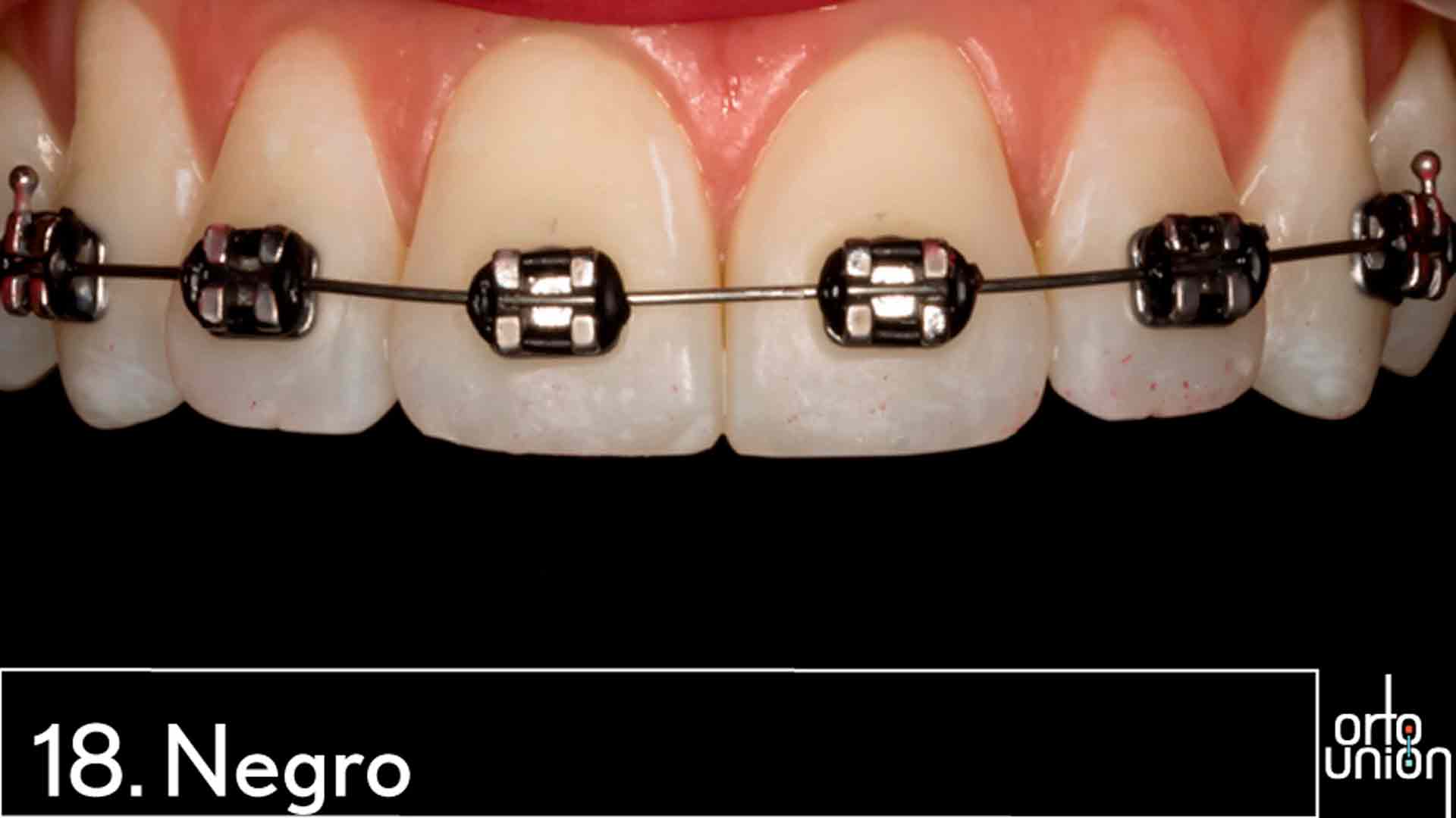 cauchos color negro para brackets