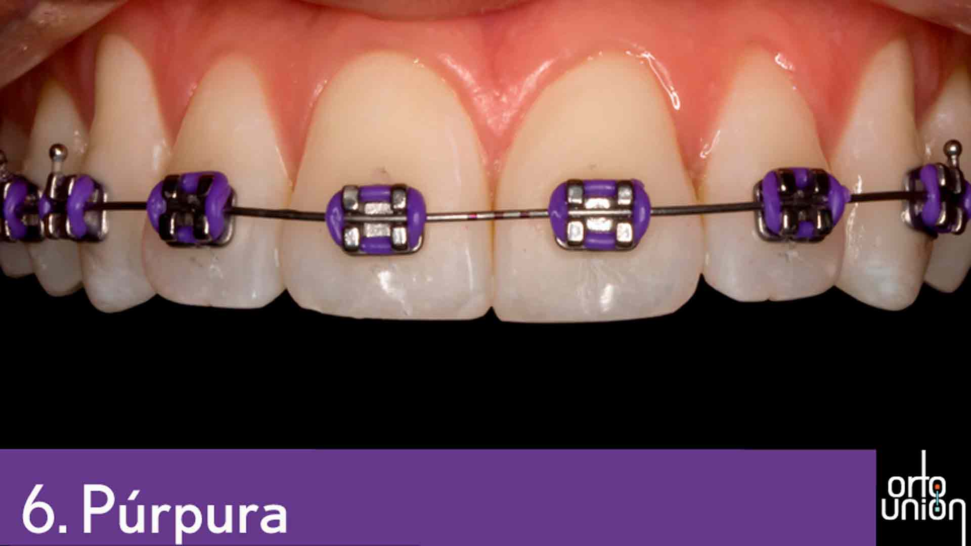 cauchos color purpura para brackets