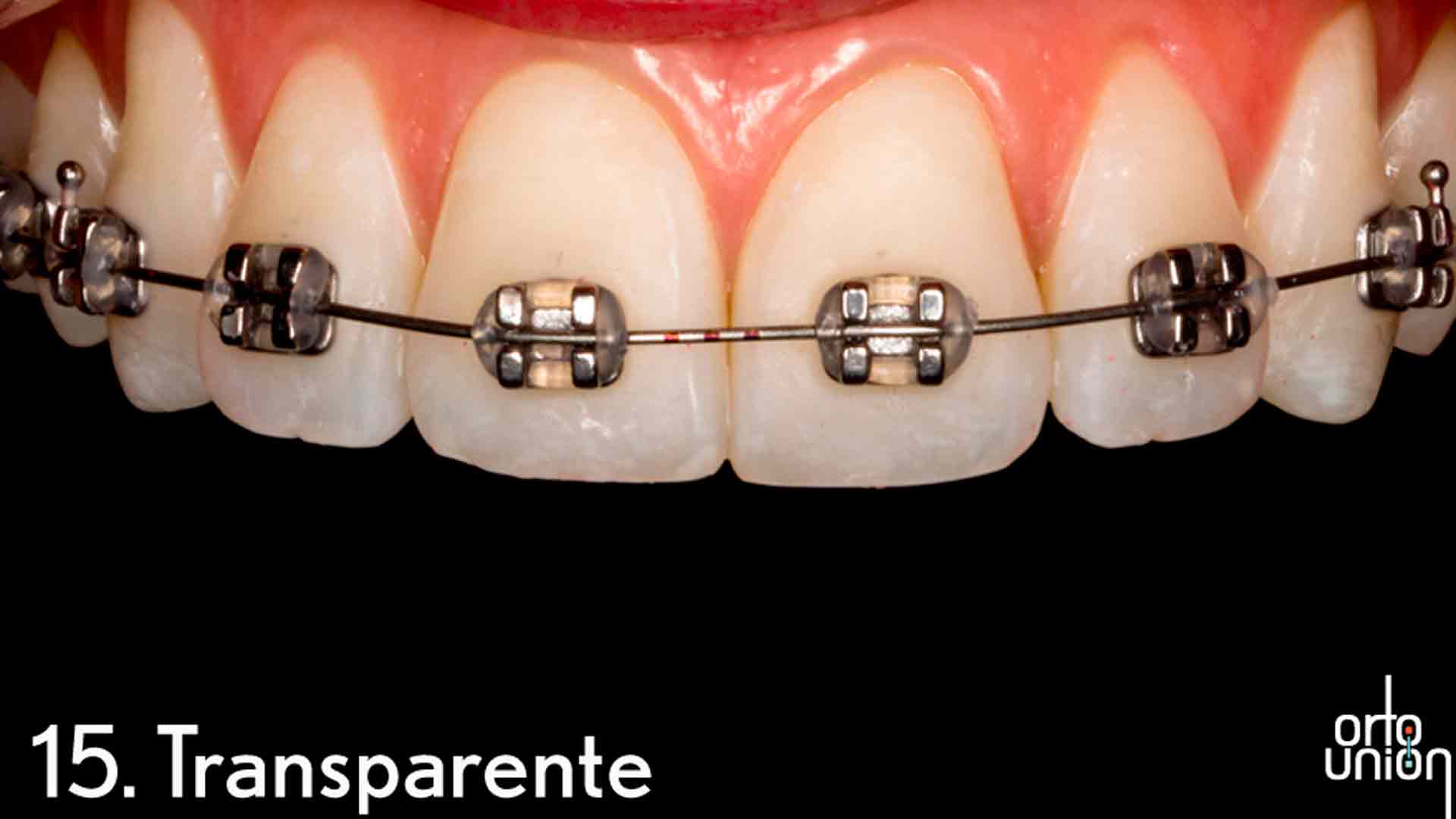 cauchos color transparente para brackets