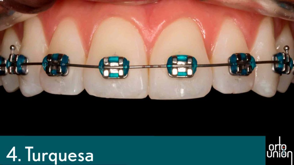 cauchos color turquesa para brackets