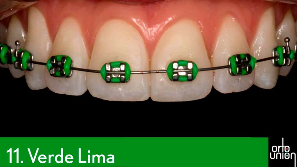 cauchos color verde lima para brackets