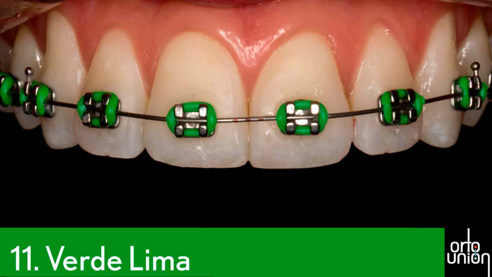 cauchos color verde lima para brackets