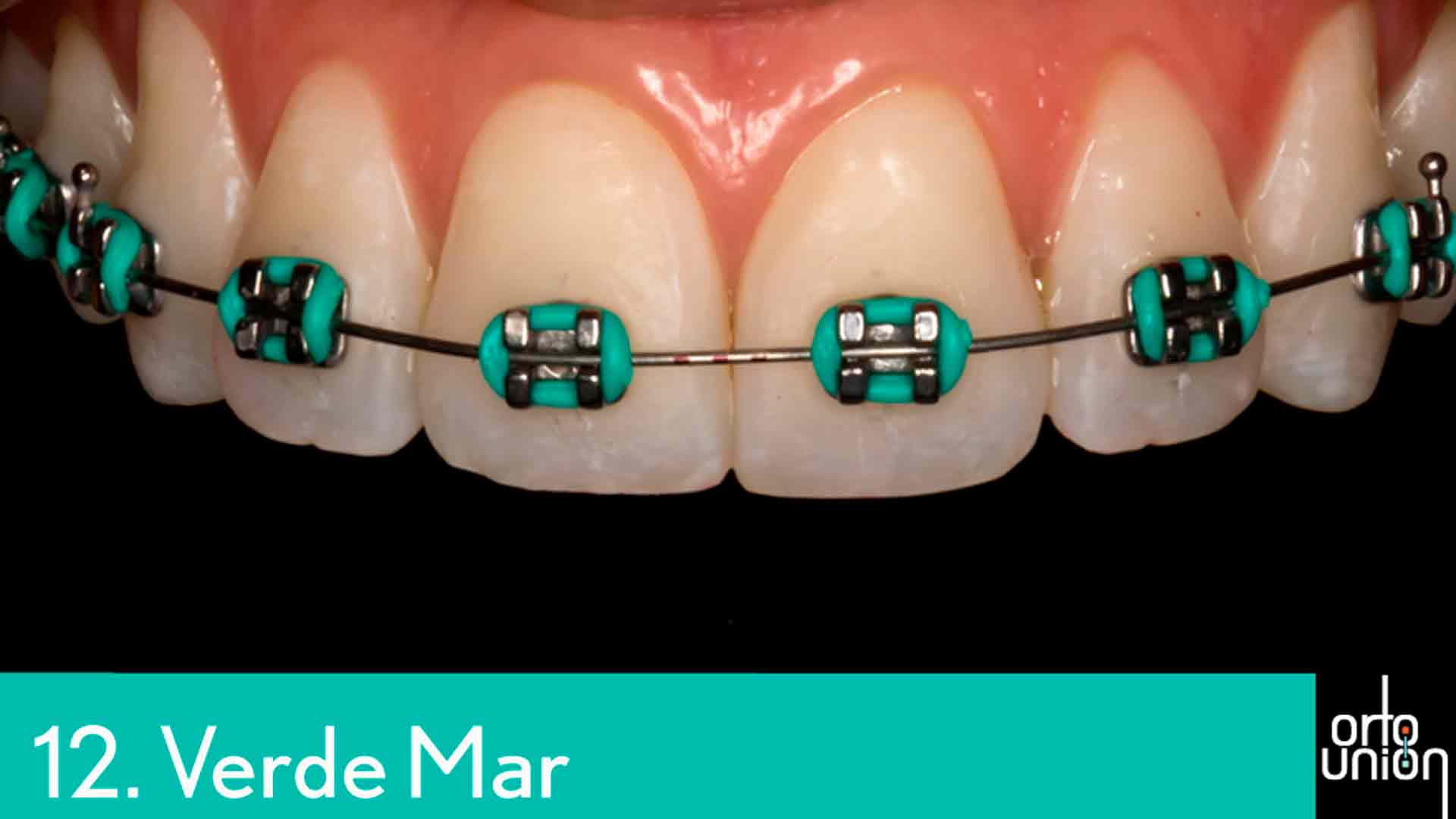 cauchos color verde mar para brackets