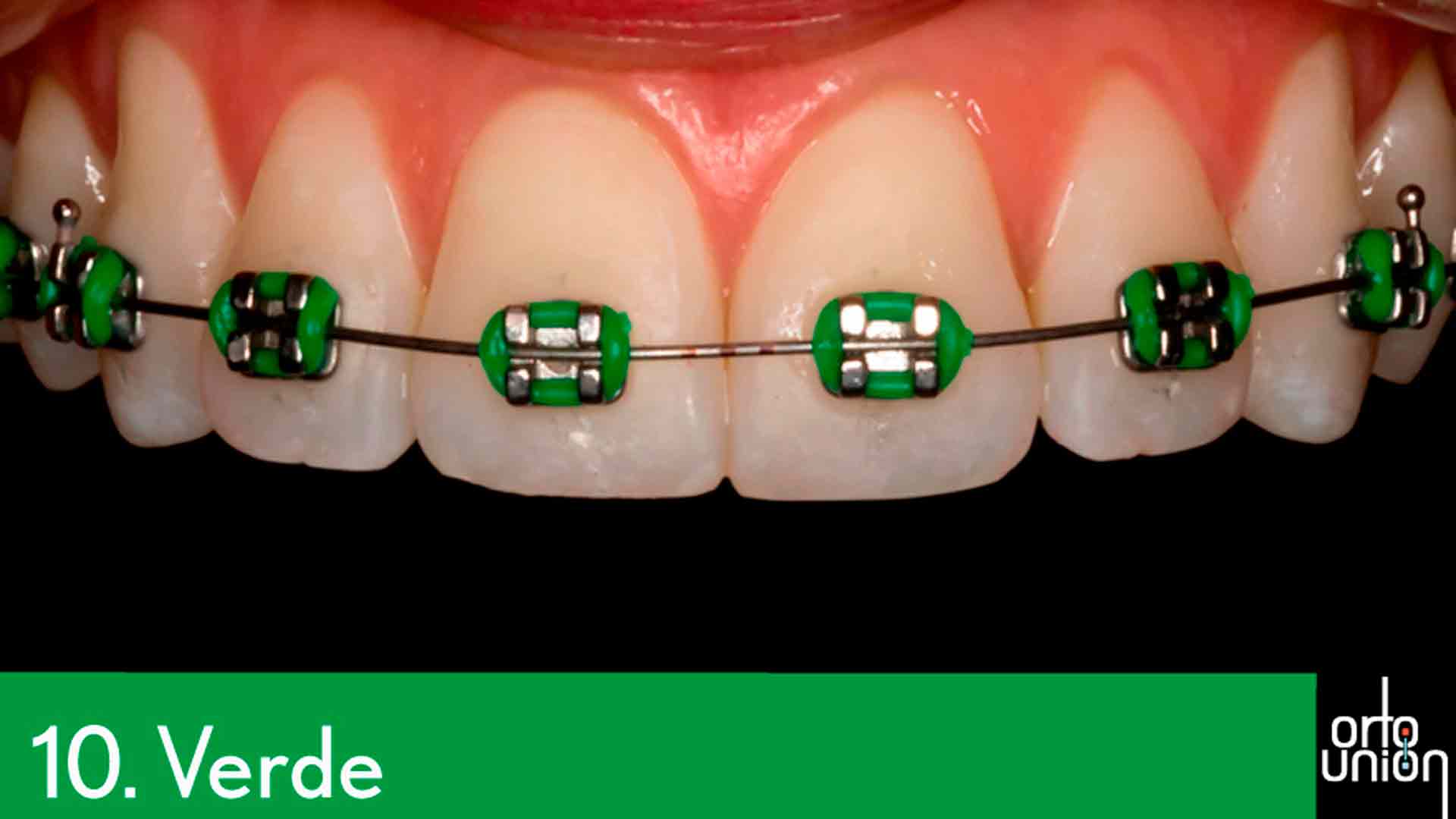 cauchos color verde para brackets
