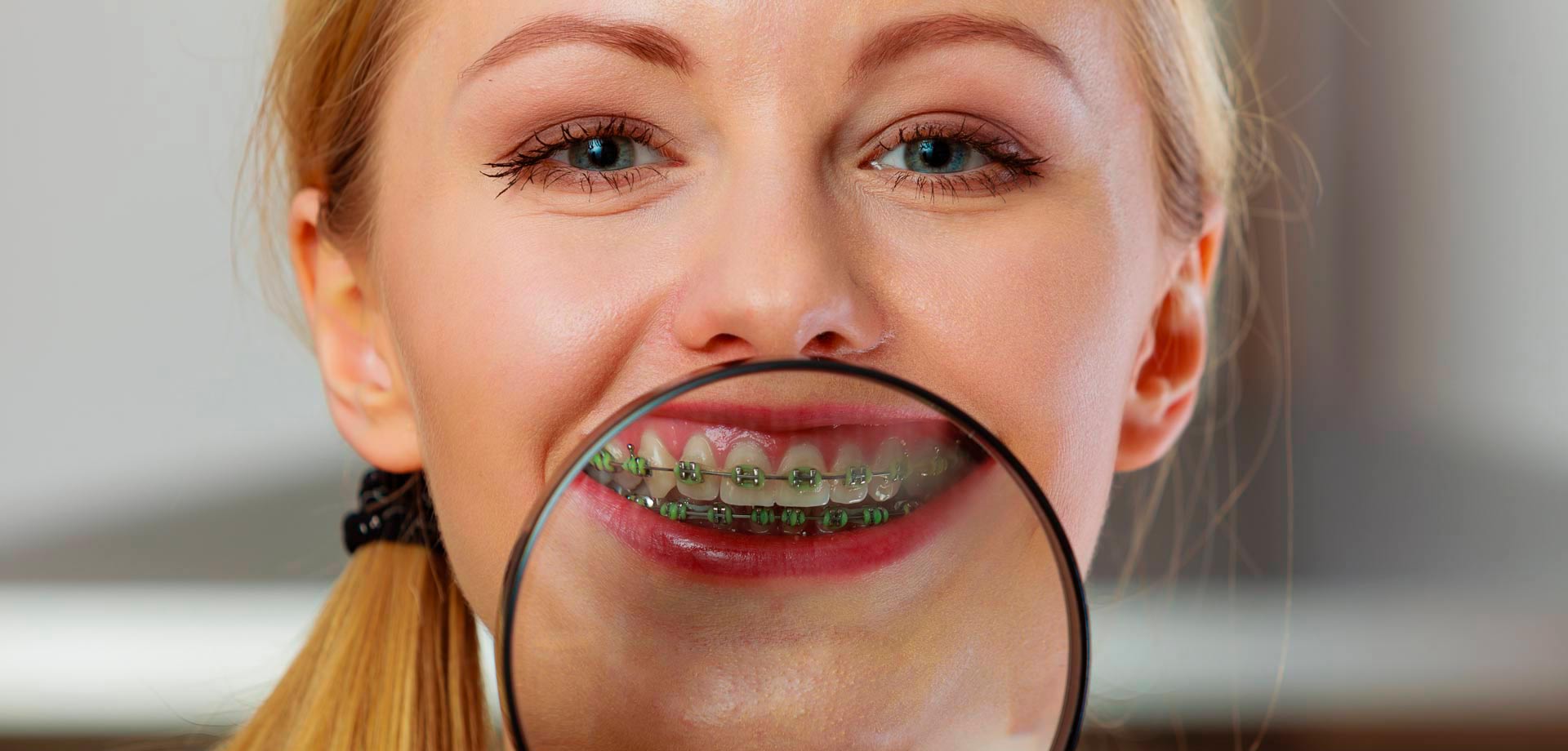 precio de brackets colombia