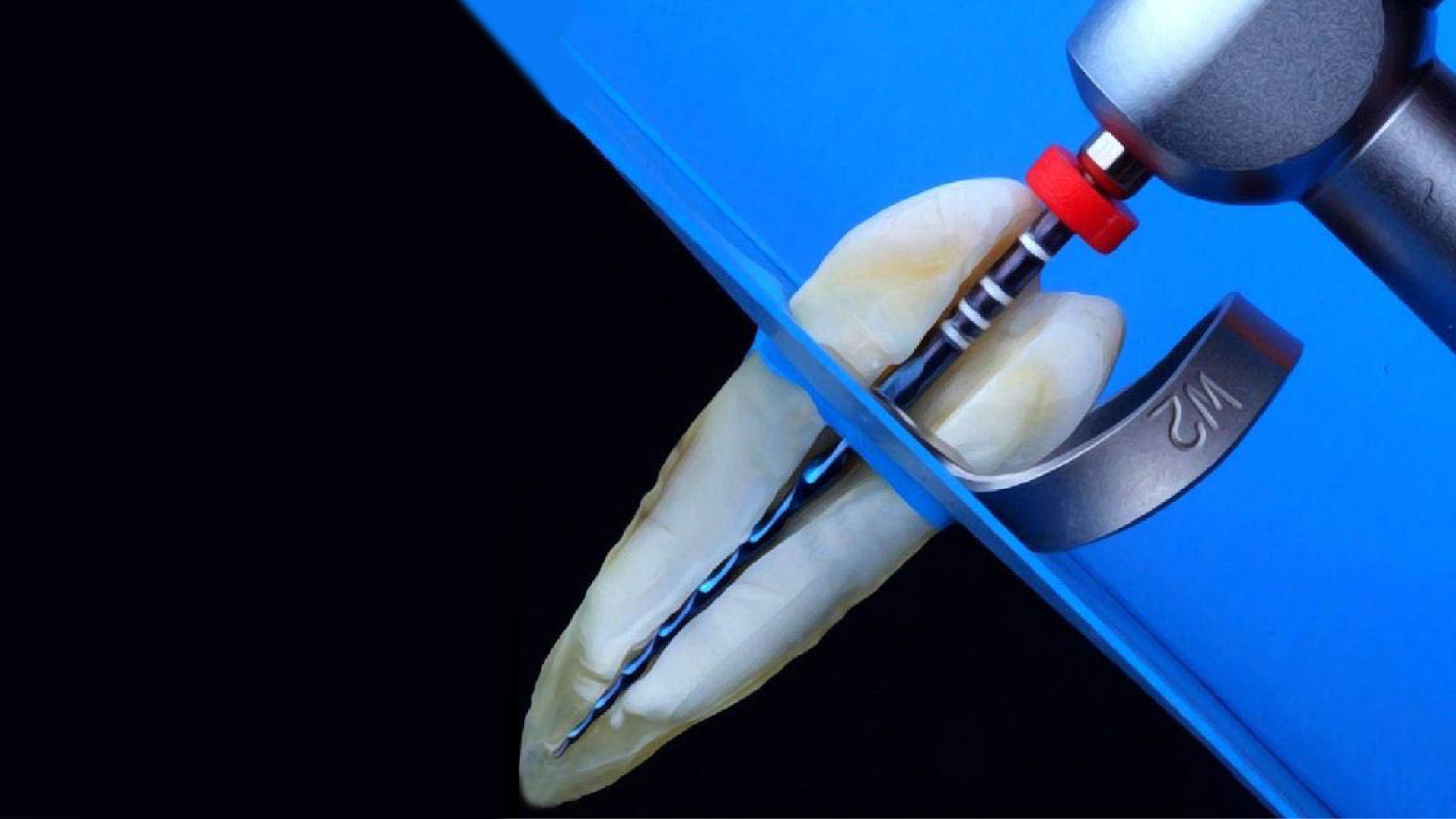 eliminación de la pulpa dental con lima rotatoria
