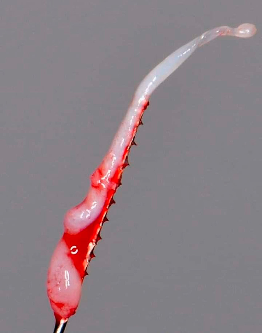 pulpa dental