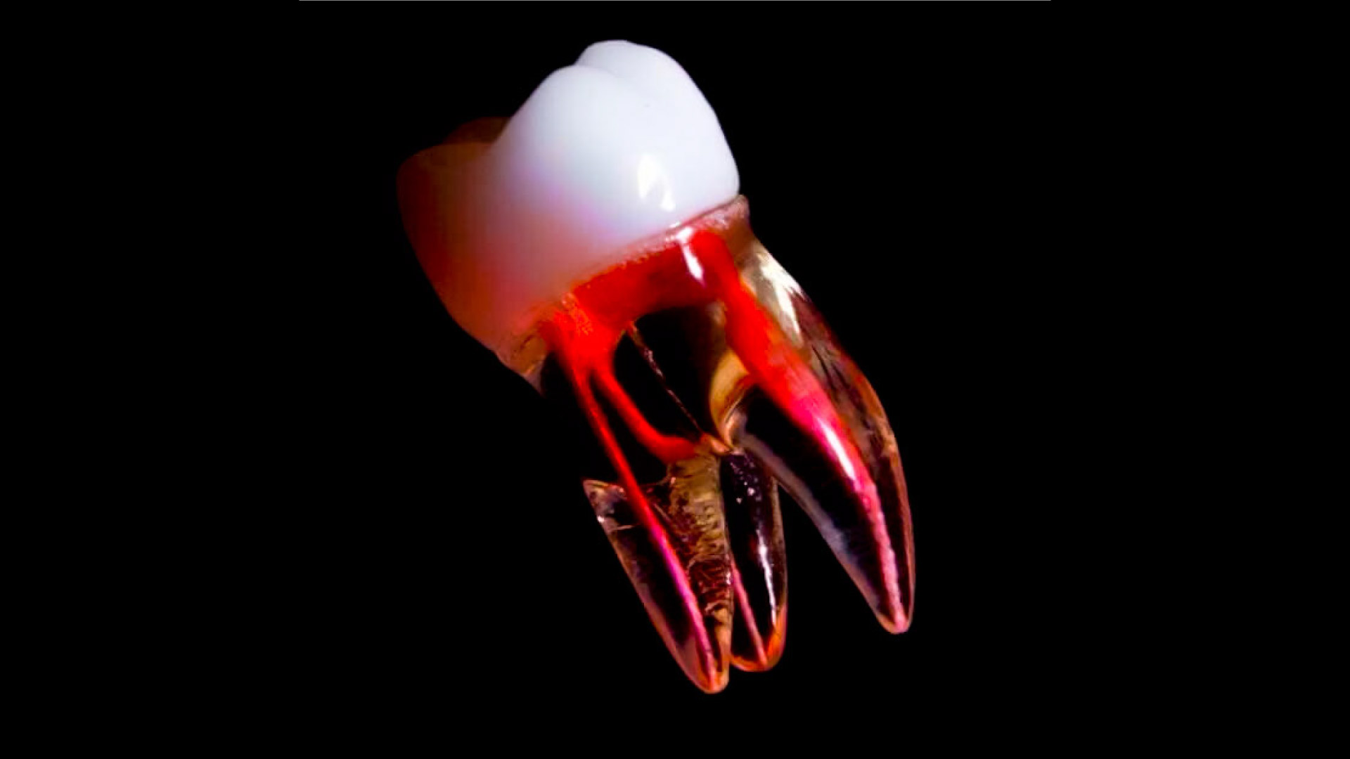 pulpa dental