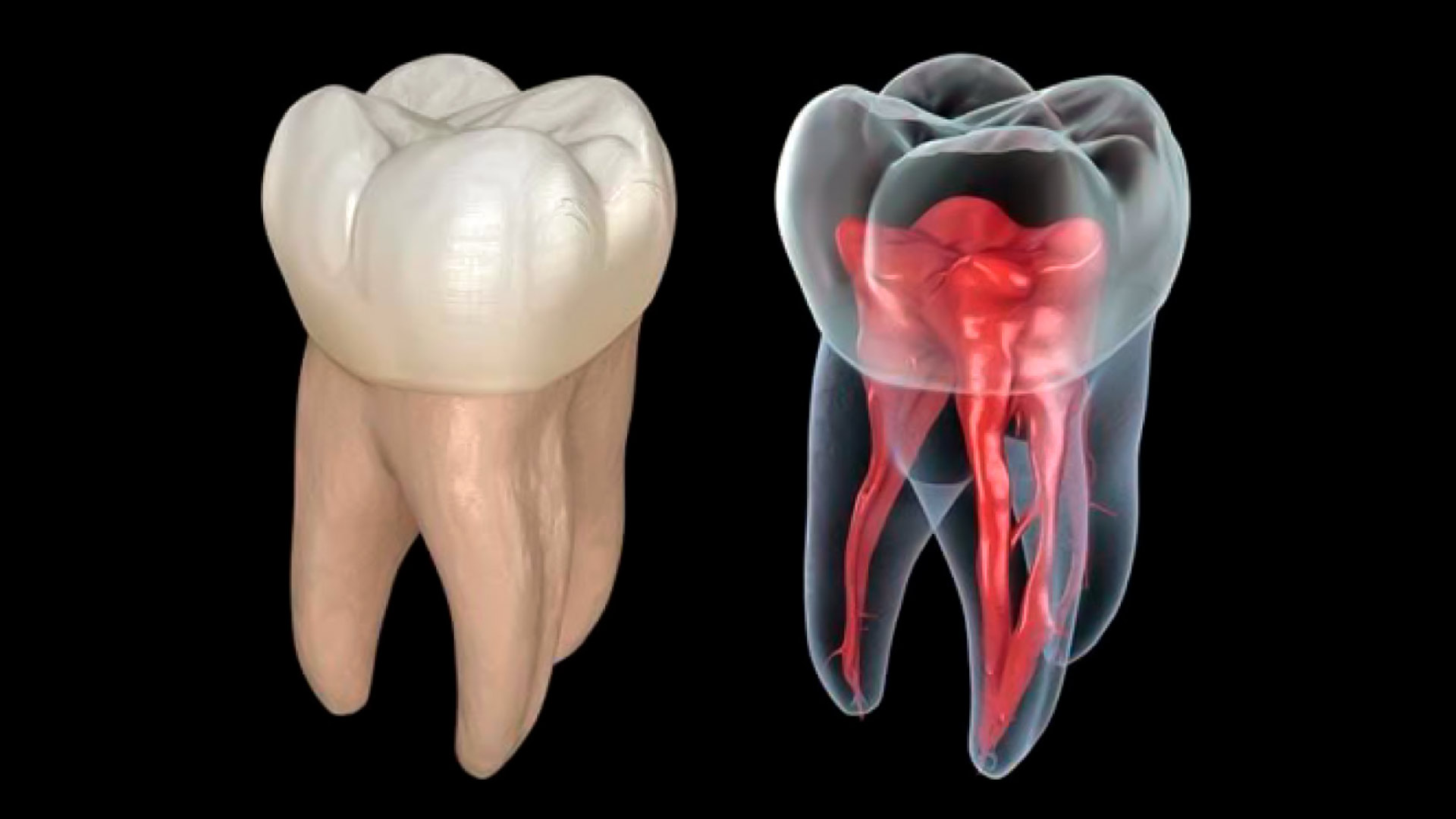 pulpa dental