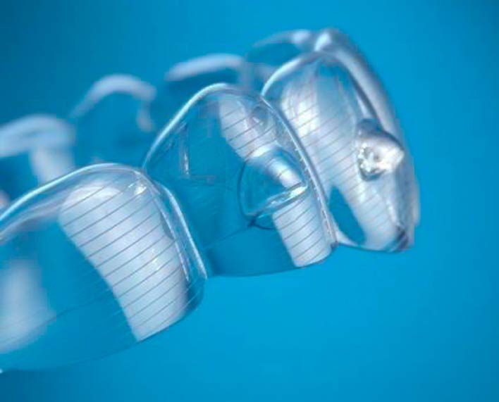 alineadores dentales en medellin