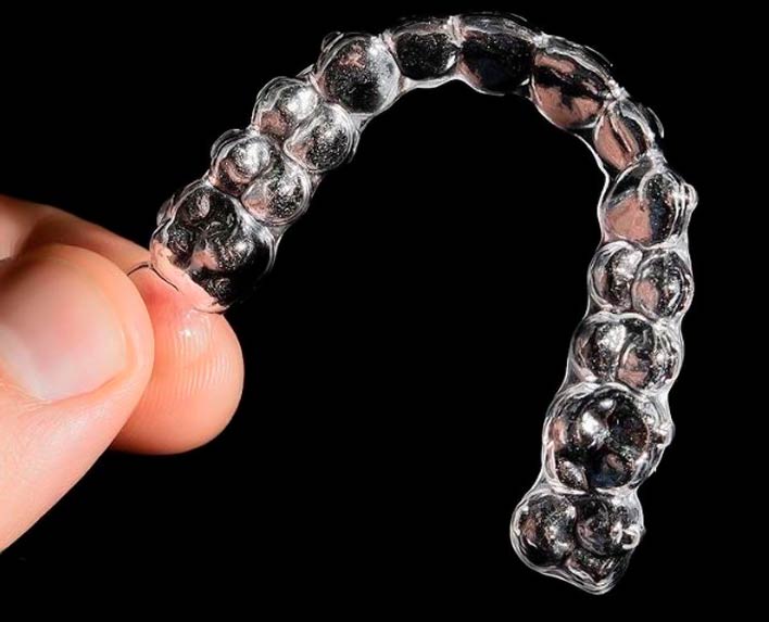 alineadores de ortodoncia invisible