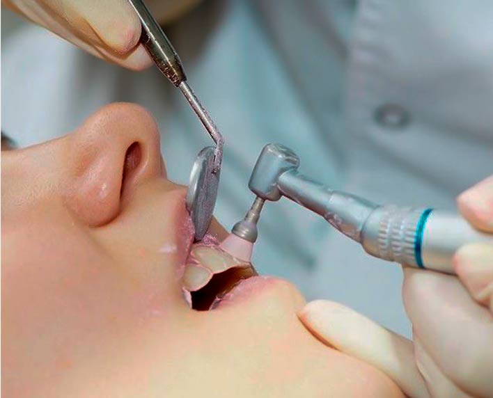 profilaxis dental en medellin